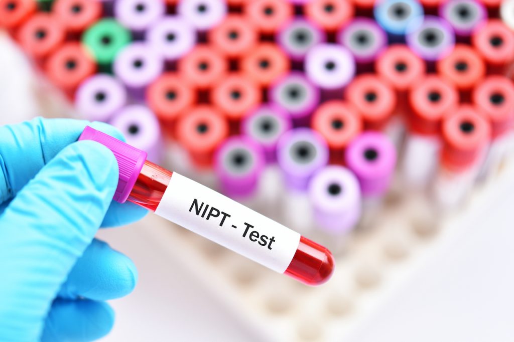 NIPT screening 